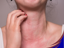 allergie air pollué